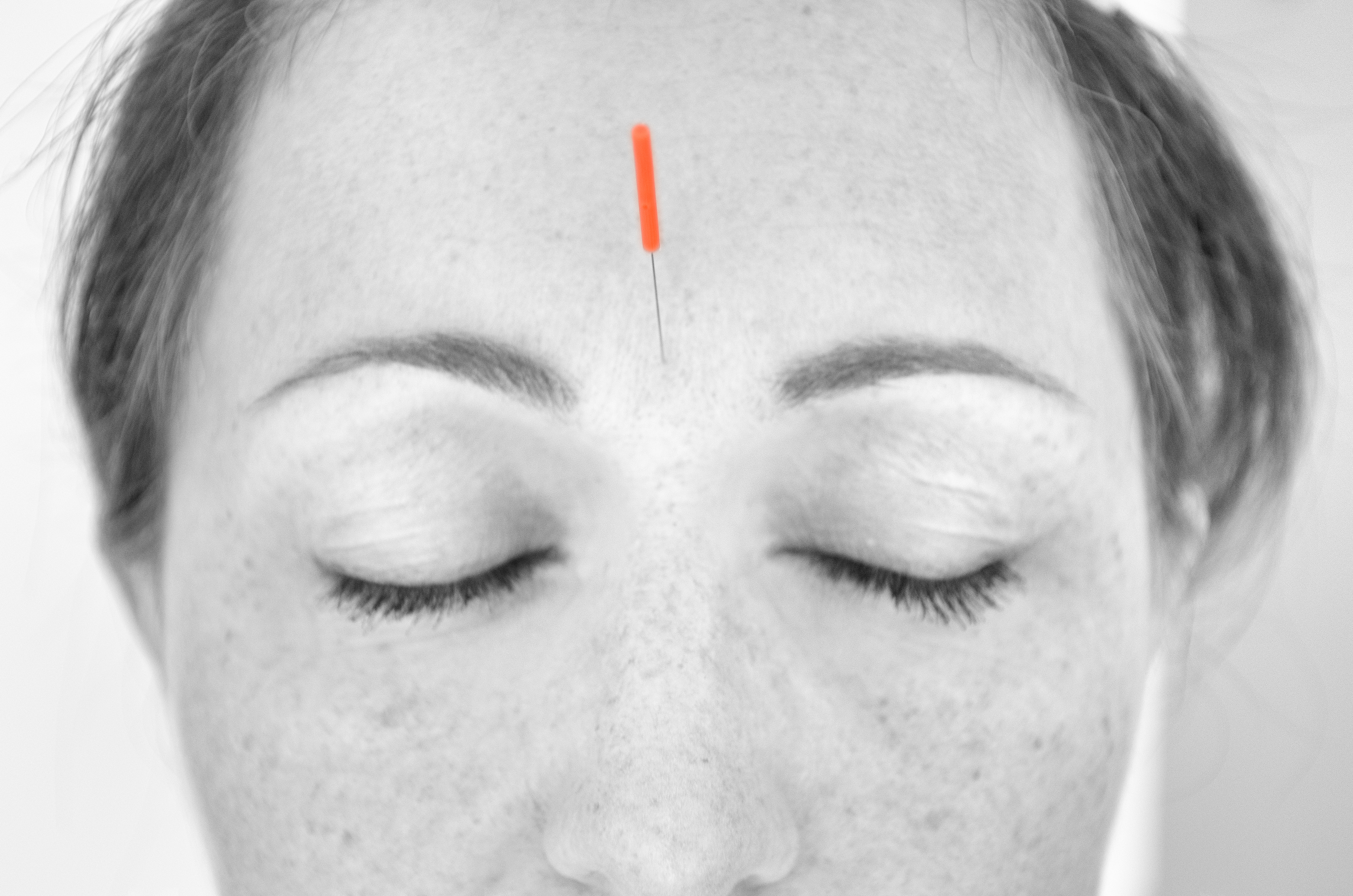 Yin Tang Acupuncture Point